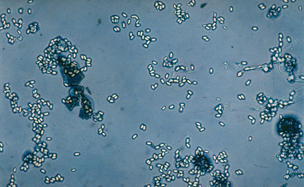 About Nosemosis (Nosema)